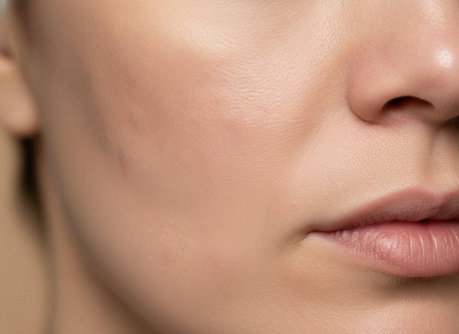 After Refined texture and softened acne scars at The Body Bar MD