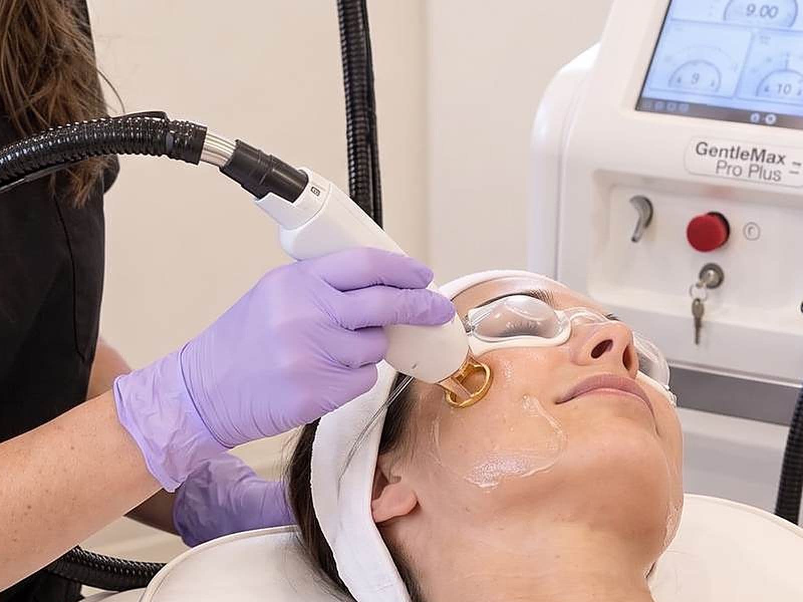 Close view of the Candela GentleMax Pro Plus handpiece and its gold ring tip pressed to a cheek