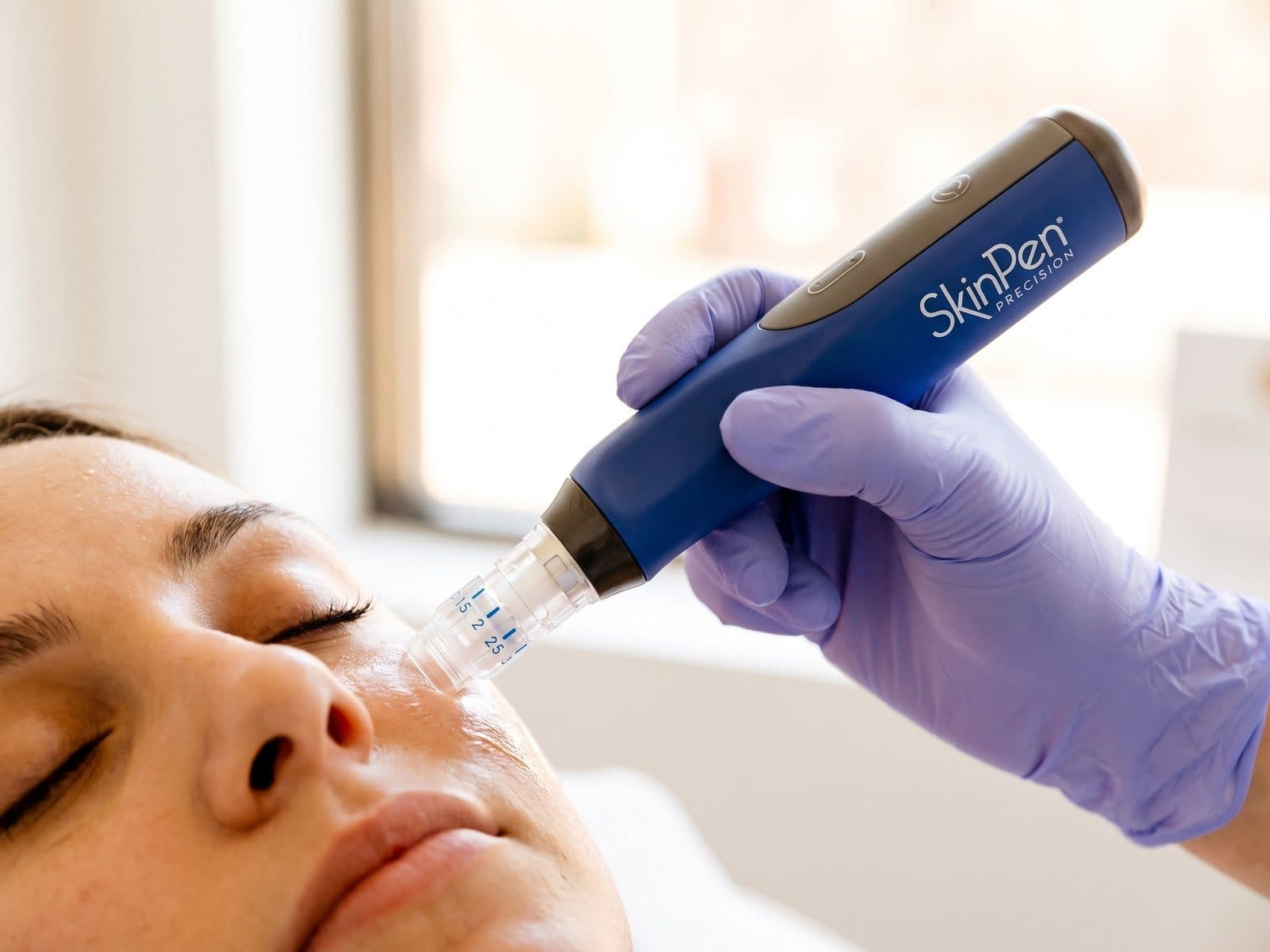 Close view of the SkinPen Precision microneedling device gliding along a cheekbone