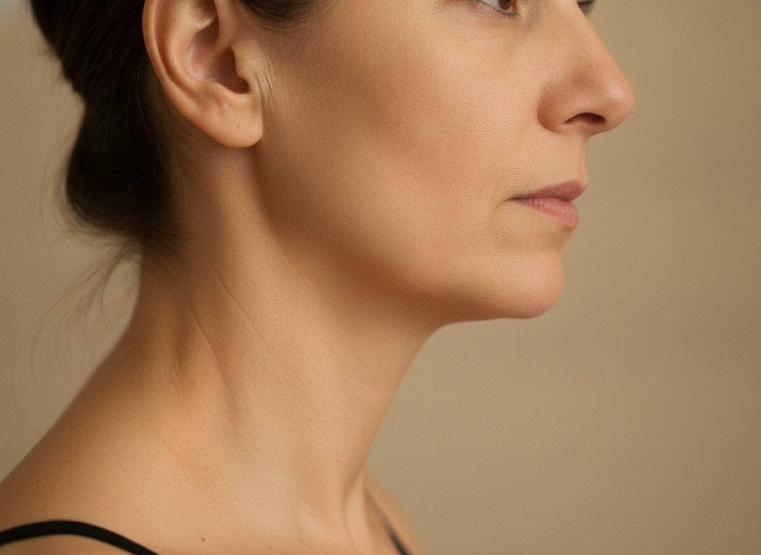 After A firmer jawline and smoother, tighter skin at The Body Bar MD
