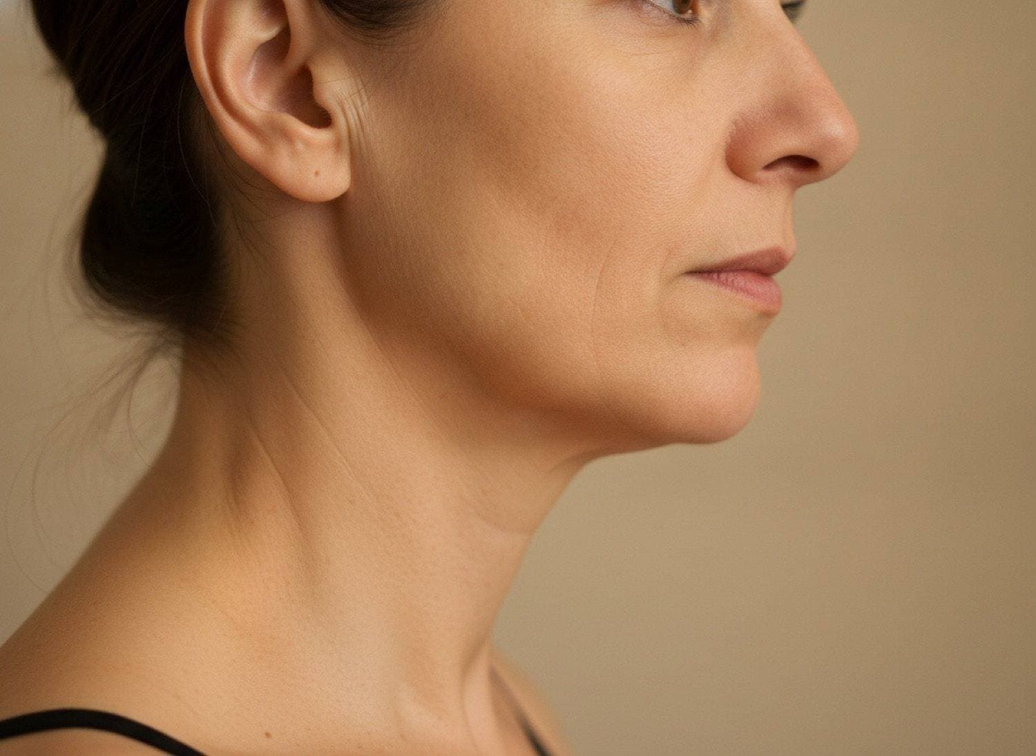 Before A firmer jawline and smoother, tighter skin at The Body Bar MD